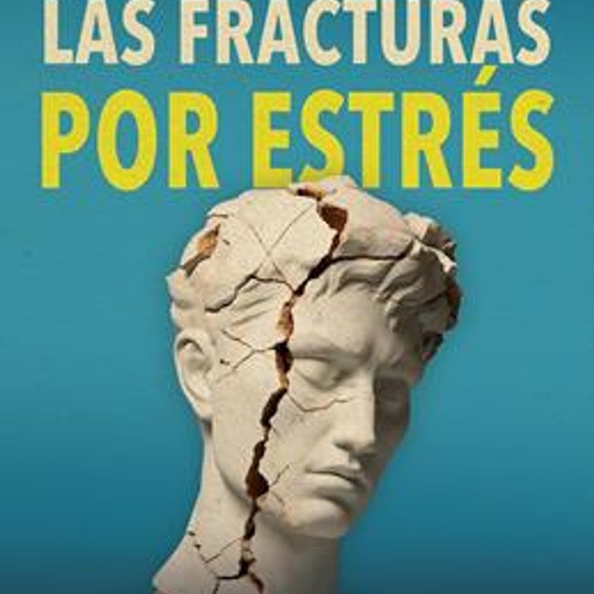Fracturas Por Estres/ Las 1 Fracturas Por Estres/ Las
